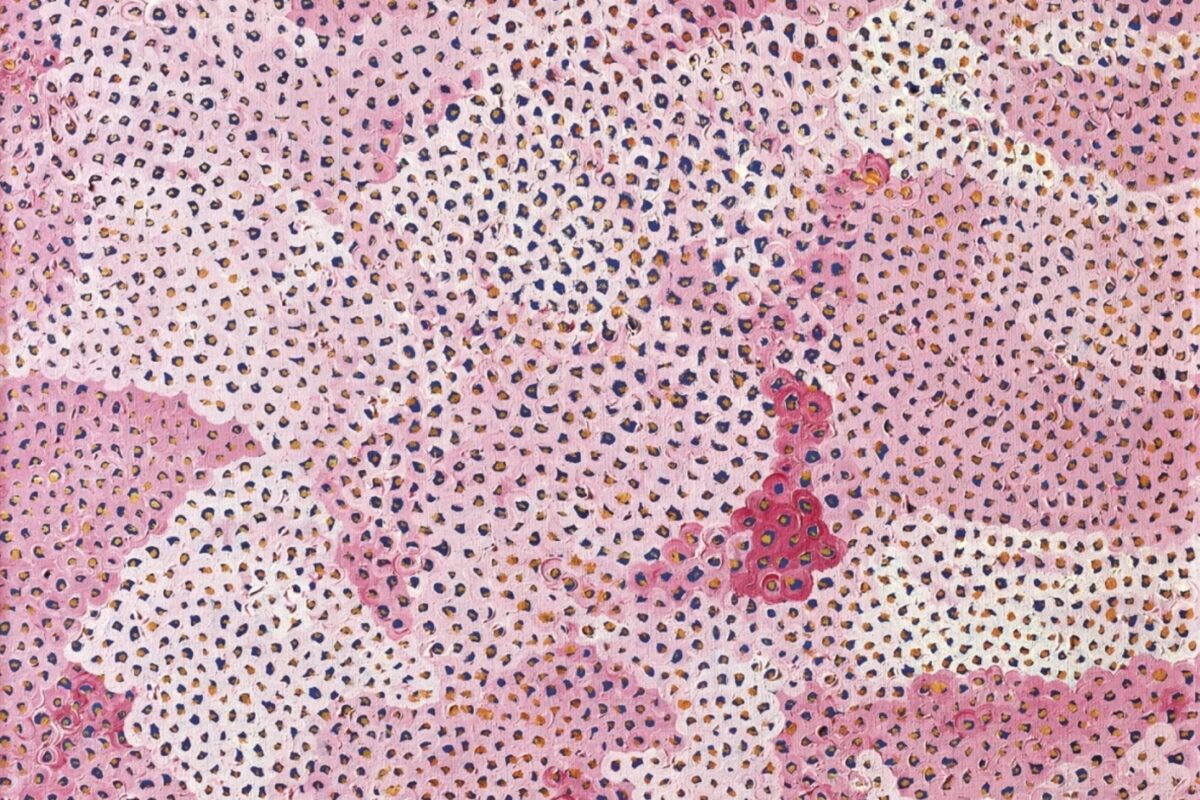 The Diverse Techniques of Yayoi Kusama
