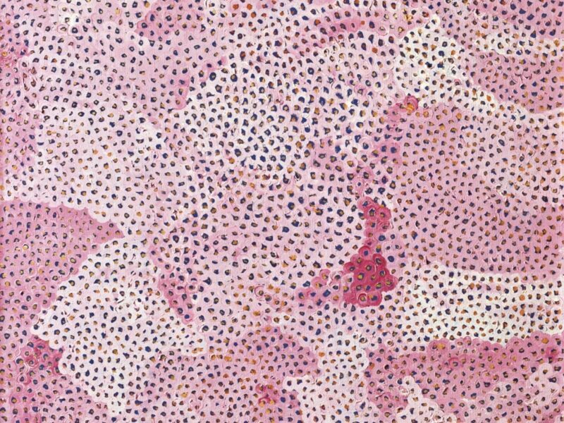 The Diverse Techniques of Yayoi Kusama